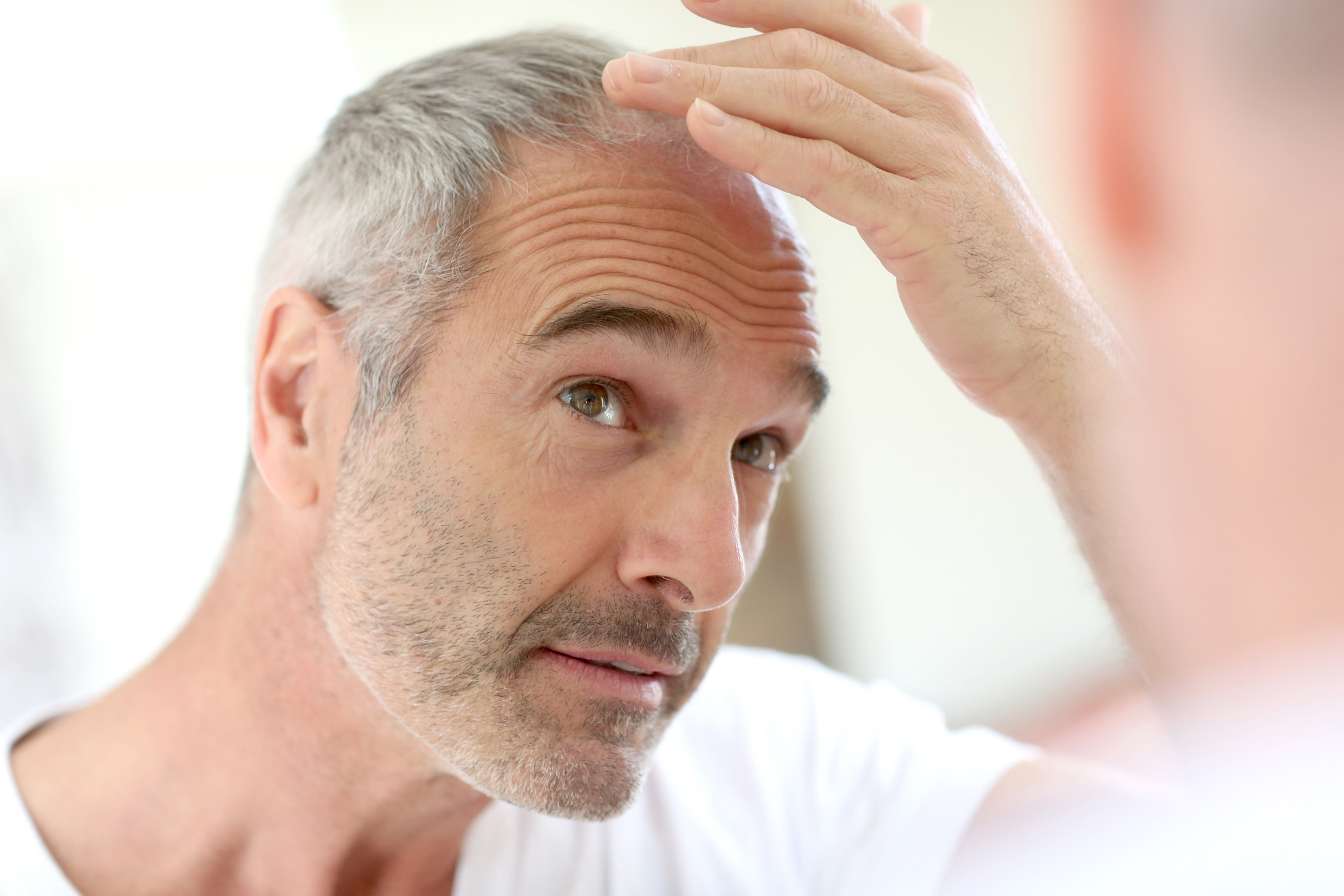 Baldness & Receding Hair Line: Best Hair Loss Treatments That Work | Men's Health Magazine Australia Baldness & Receding Hair Line: Best Hair Loss Treatments That Work | Men's Health Magazine Australia