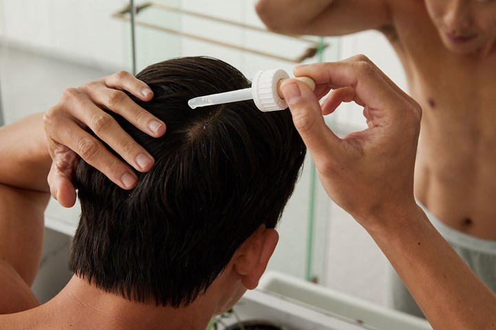 hair-loss-3