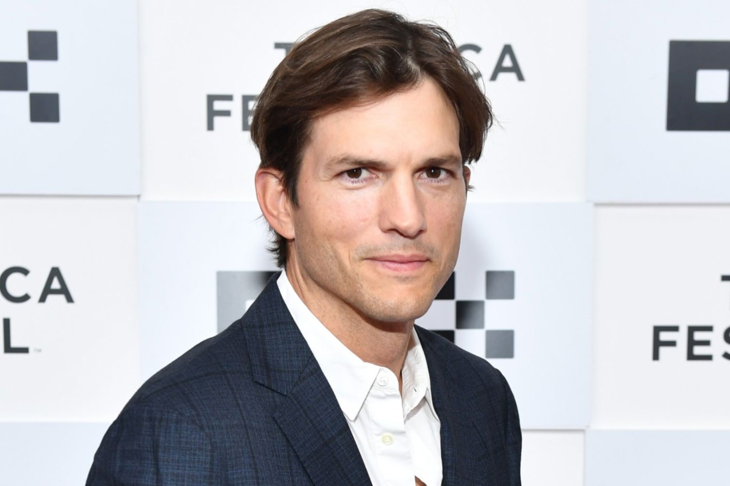Ashton Kutcher Reveals Battle With Vasculitis: Here’s What You Need To ...